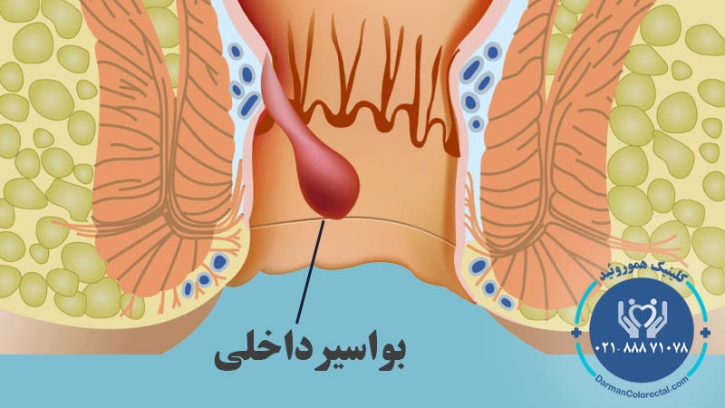 -داخلی.jpg